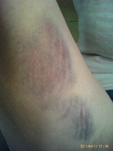 207441_10150140706165966_52077